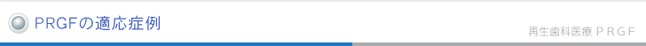 PRGFの適応症例